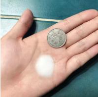 脖子被太阳晒黑了怎么才能变白,被太阳晒黑怎样变白女生