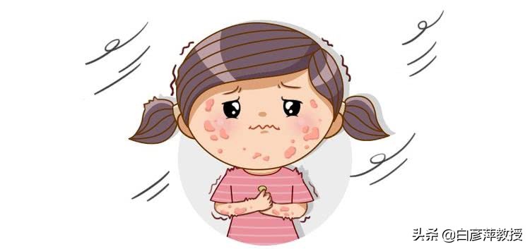 什么叫荨麻疹荨麻疹是怎么引起的,荨麻疹的类型都有哪几种