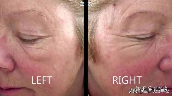 见效最快的美白护肤品有副作用吗,见效很快的美白产品能用吗