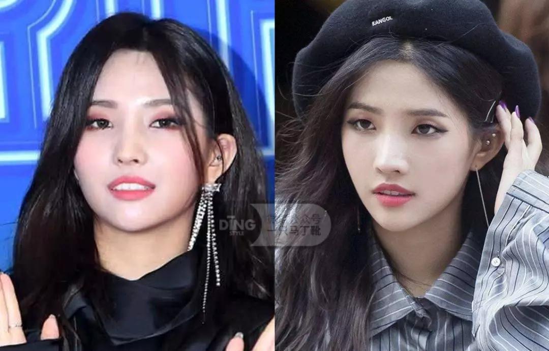 戴牙套凸嘴怎么化妆,凸嘴整牙削骨吗