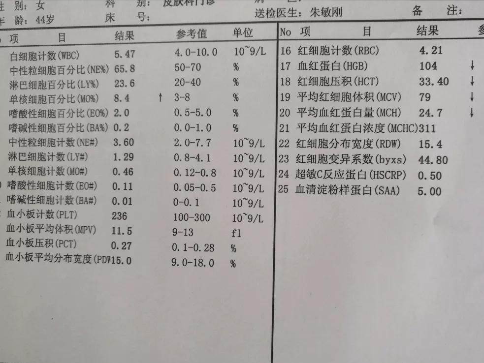 感染和炎症对血常规有影响吗,血管炎抗炎治疗