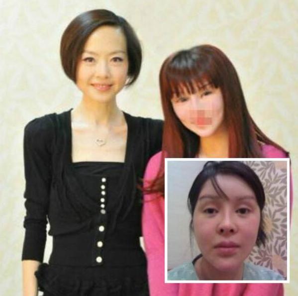 红粉宝宝整容失败案例,粉红女郎整容200多次