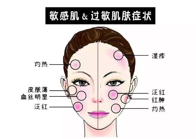 婴儿针修复敏感肌,婴儿针修复敏感肌效果