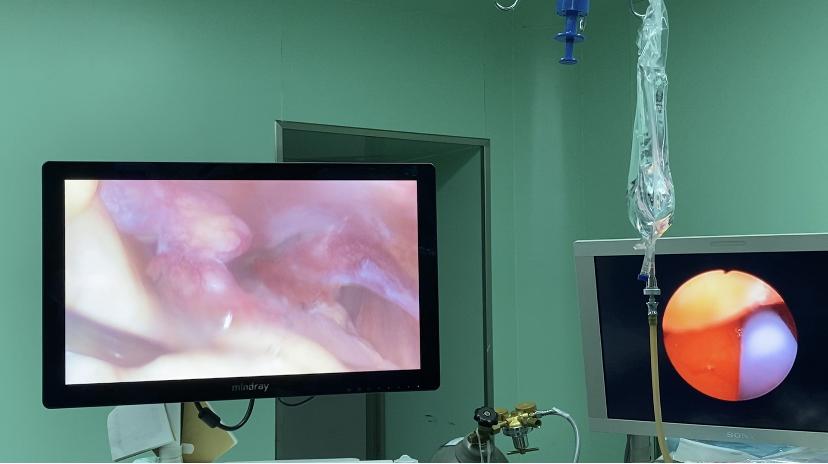 医心向党医心为民活动实施方案,不孕做宫腹腔镜有效果吗