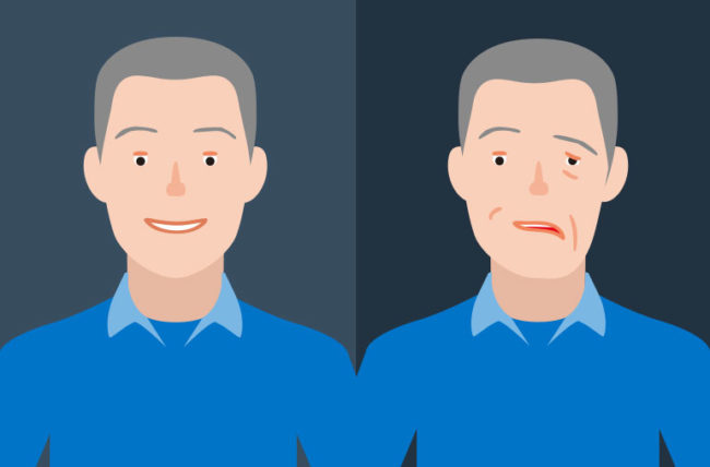 冷风导致的面瘫嘴歪,从中医角度看待面瘫嘴歪