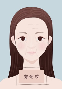 如何预防法令纹最有效的办法,教你淡化法令纹的好方法