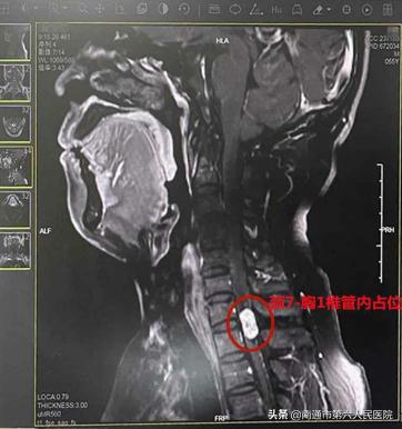 双腿无力中医治疗心得,双腿残疾忍辱负重