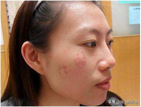 长斑最好的三种食物,去褐斑的食物