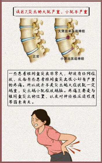 腰椎间盘突出症的诊疗漫画版,腰椎间盘突出症状表现漫画