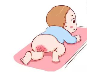 钧钧妈分享:新生儿吐奶、打嗝、腹胀、黄疸……,怎么办?