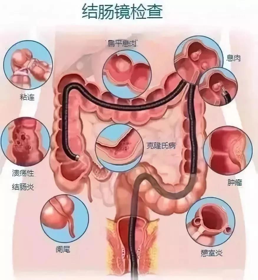 肛肠科医患沟通七个讲明白,肛肠问题怎么咨询