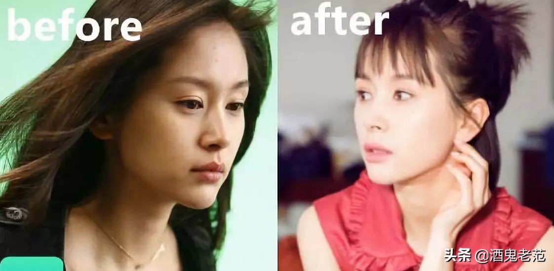 整容成小三,整容变美却嫁给丑八怪