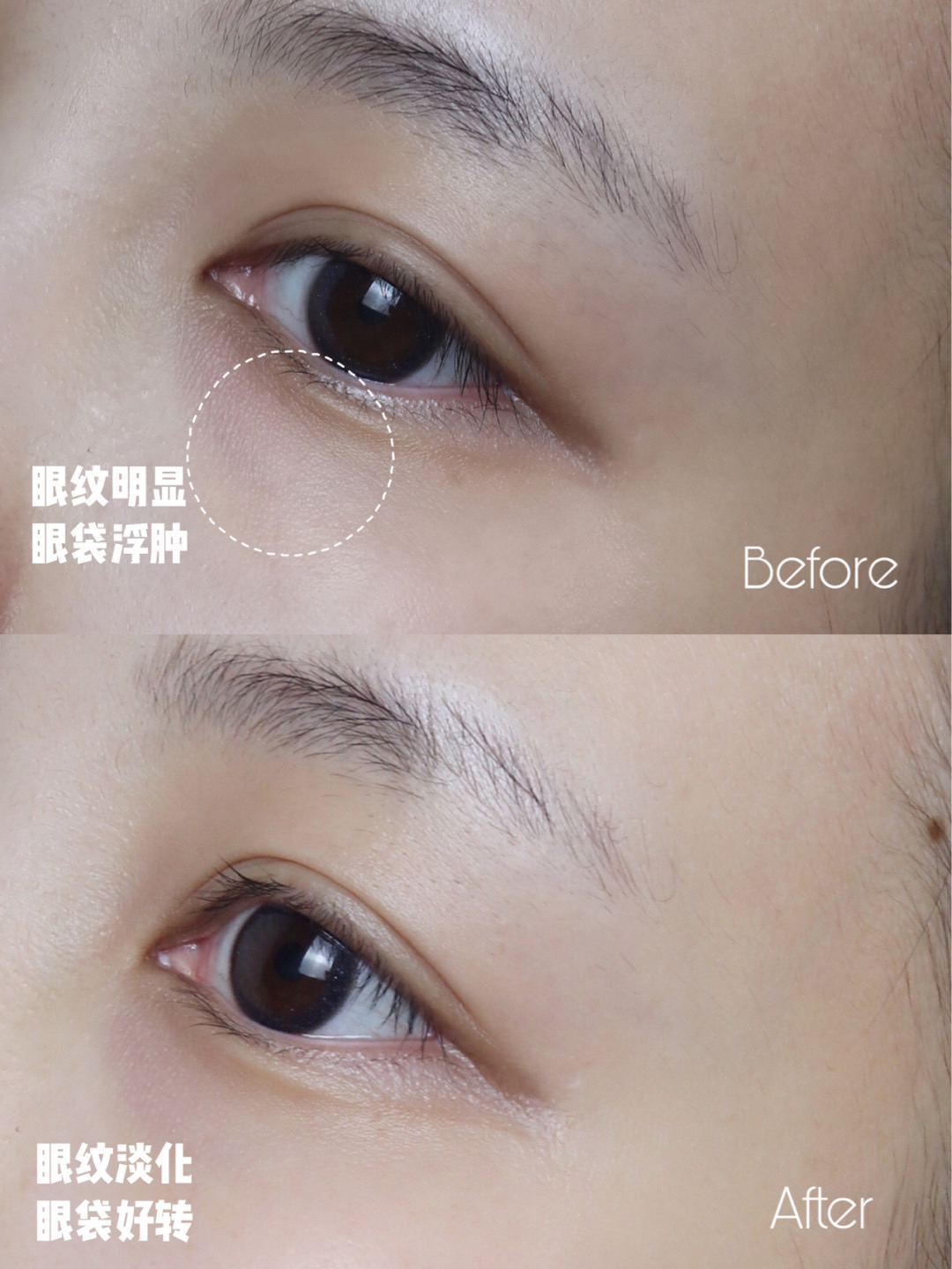 世界顶级抗皱眼霜,最好用的贵妇眼霜排行榜