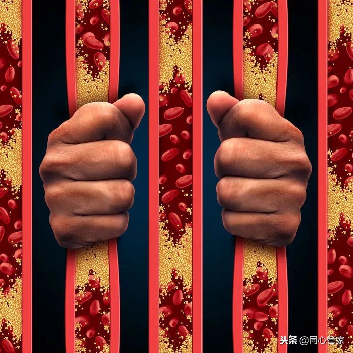 肾功能不全禁用哪种利尿剂,长期服用利尿剂的功效和副作用