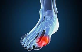 尿酸高不用药能自然恢复吗,尿酸高最快的恢复方法就是多喝水