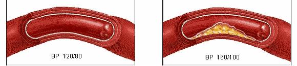 经络不通百病生视频,经络不通寒湿淤堵百病丛生