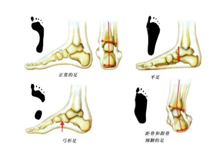 轻巧又适合扁平足的耐克鞋,平足nike