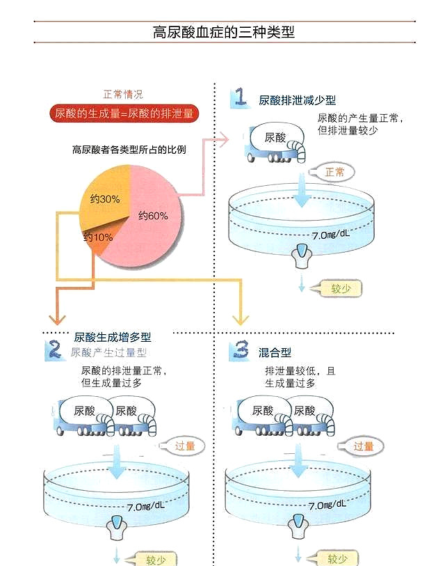 治痛风降尿酸记住这10点,运动排汗痛风