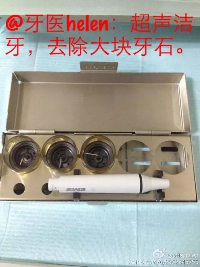 Helen齿科中心——超声波洁牙