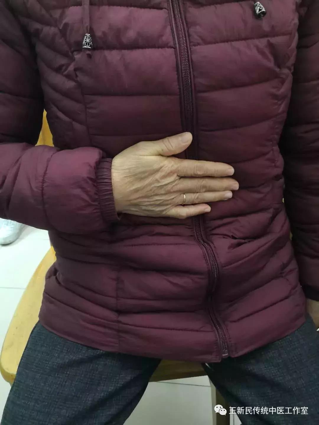 中医院王新民医术,王新民省中医院