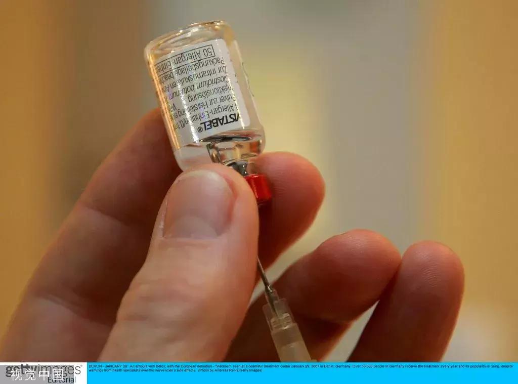 肉毒素中毒女孩后续,胶州打除皱针