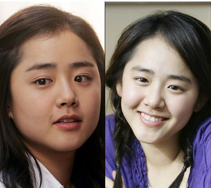 胖脸怎么减肥最有效,大肥脸是怎么减肥的