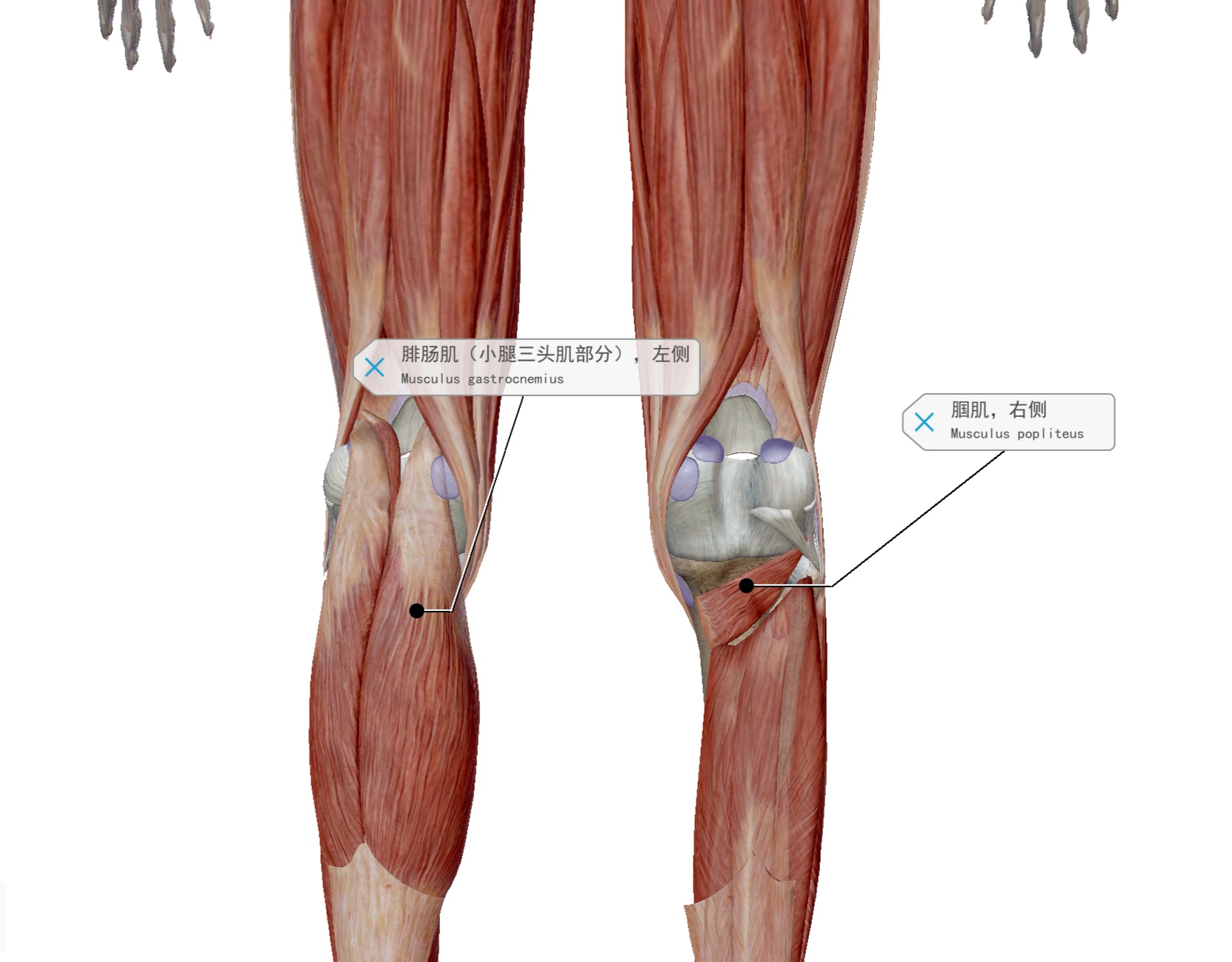 跑步膝盖外侧髂胫束如何快速恢复,跑步膝关节内侧痛的原因和治疗