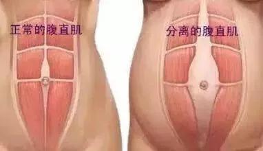 生完宝宝为什么肚子很难瘦,生完2个孩子肚子还能瘦吗