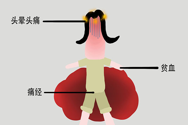 轻度脑梗要注意哪些,轻度脑梗前兆打什么药