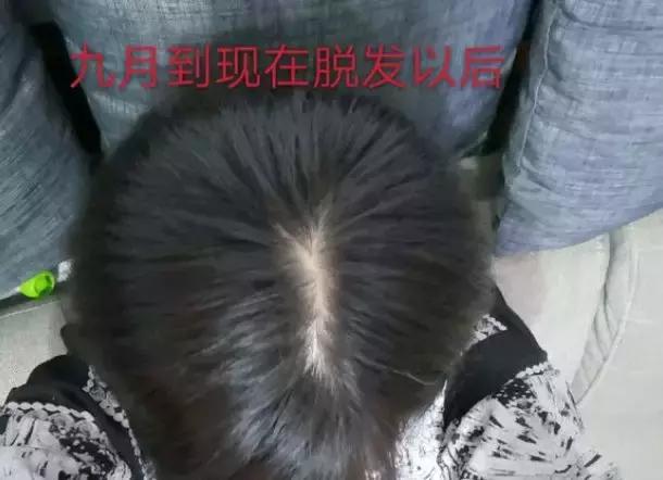 吃了优甲乐身体变瘦为什么,吃了优甲乐还严重起来啥原因