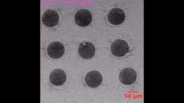 显微镜下的人类卵子和精子,人类首次拍到卵细胞