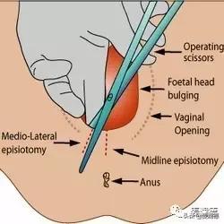 产后困扰你的问题,产后生活的柴米油盐