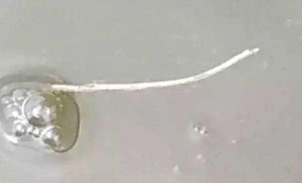 南美白对虾白便处理一例,南美白对虾白便的形成过程