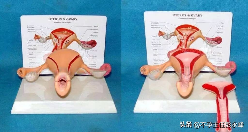 卵巢是女人的子宫吗,卵巢子宫是一回事吗