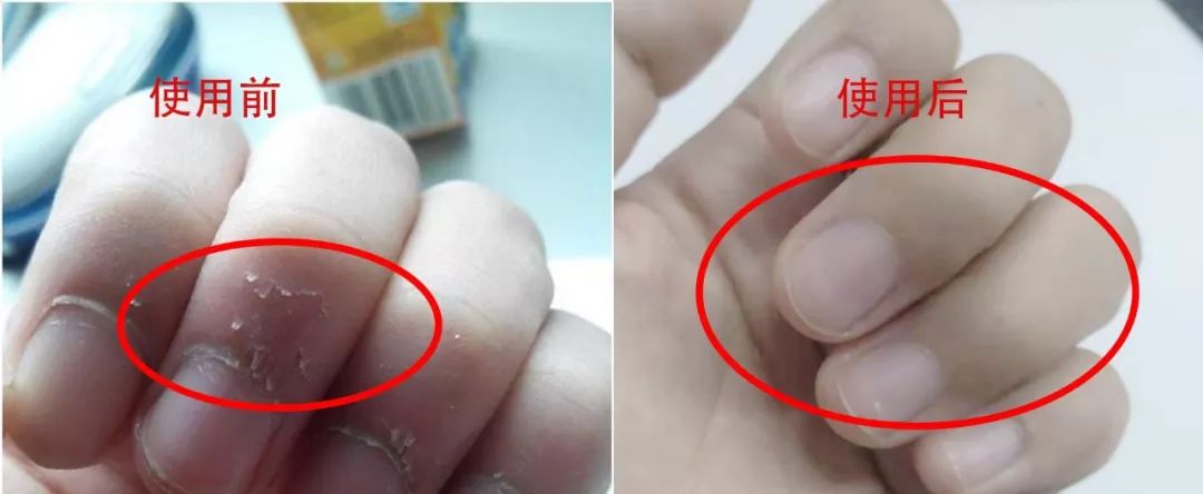 手干燥粗糙手纹深用什么护肤产品,可以改善手纹粗糙的护手霜