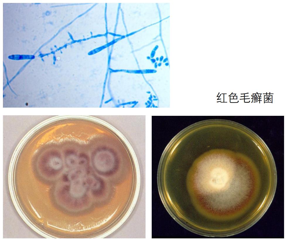 家里治脚气最好的方法,家庭治脚气的最好方法