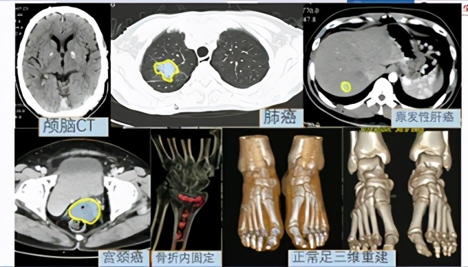 就业率最高的专业排名前十,就业热门专业排名前十名