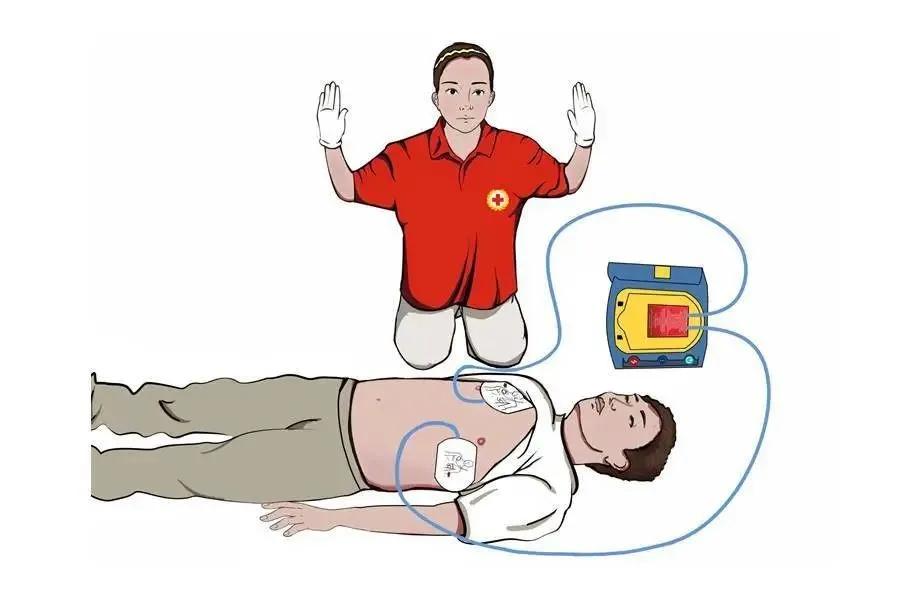 埃里克森晕倒做了什么样的手术,埃里克森植入的是全皮下icd吗
