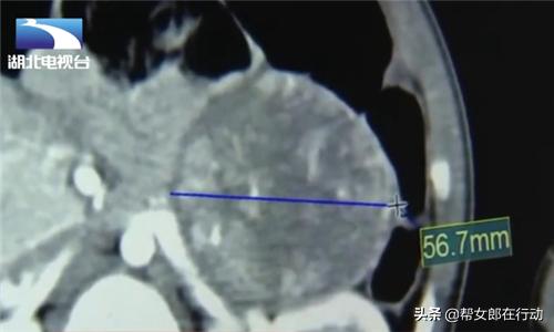 小男孩举止女性化,12岁孩子举止
