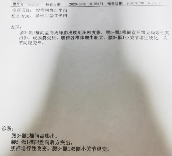 腰痛腿麻怎么治疗 (腰痛大小腿酸痛脚趾麻要怎么治疗)