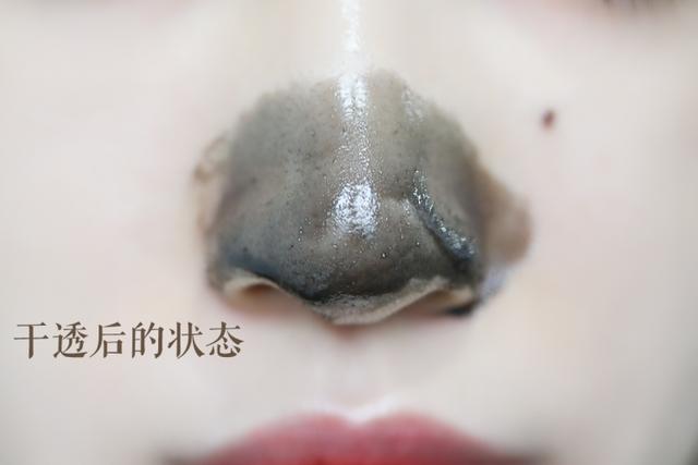 去黑头巨好用护肤品套装,草莓鼻去黑头套装