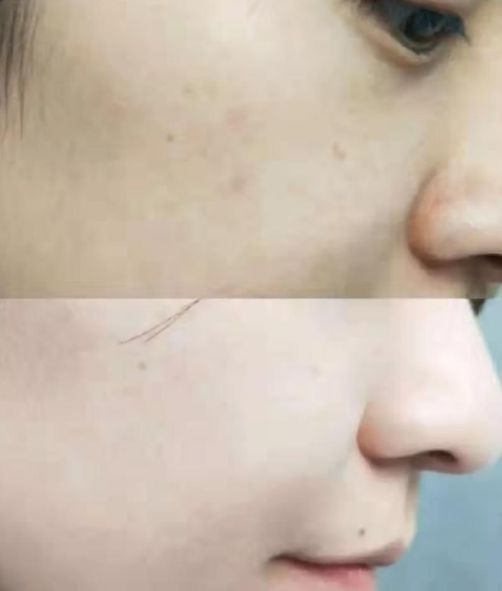 美白祛黄提亮肤色泡水喝,每天喝一杯可以美白淡斑清热解毒