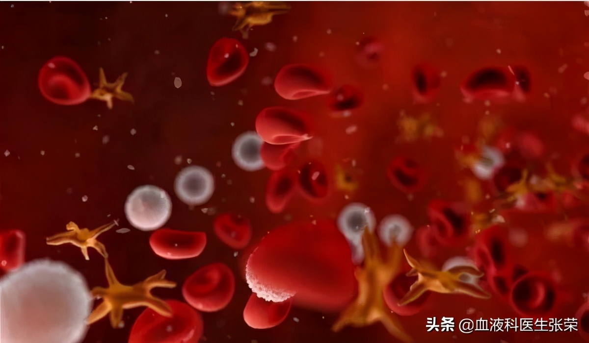 成人原发免疫性血小板减少症,原发免疫性血小板减少症能治愈吗