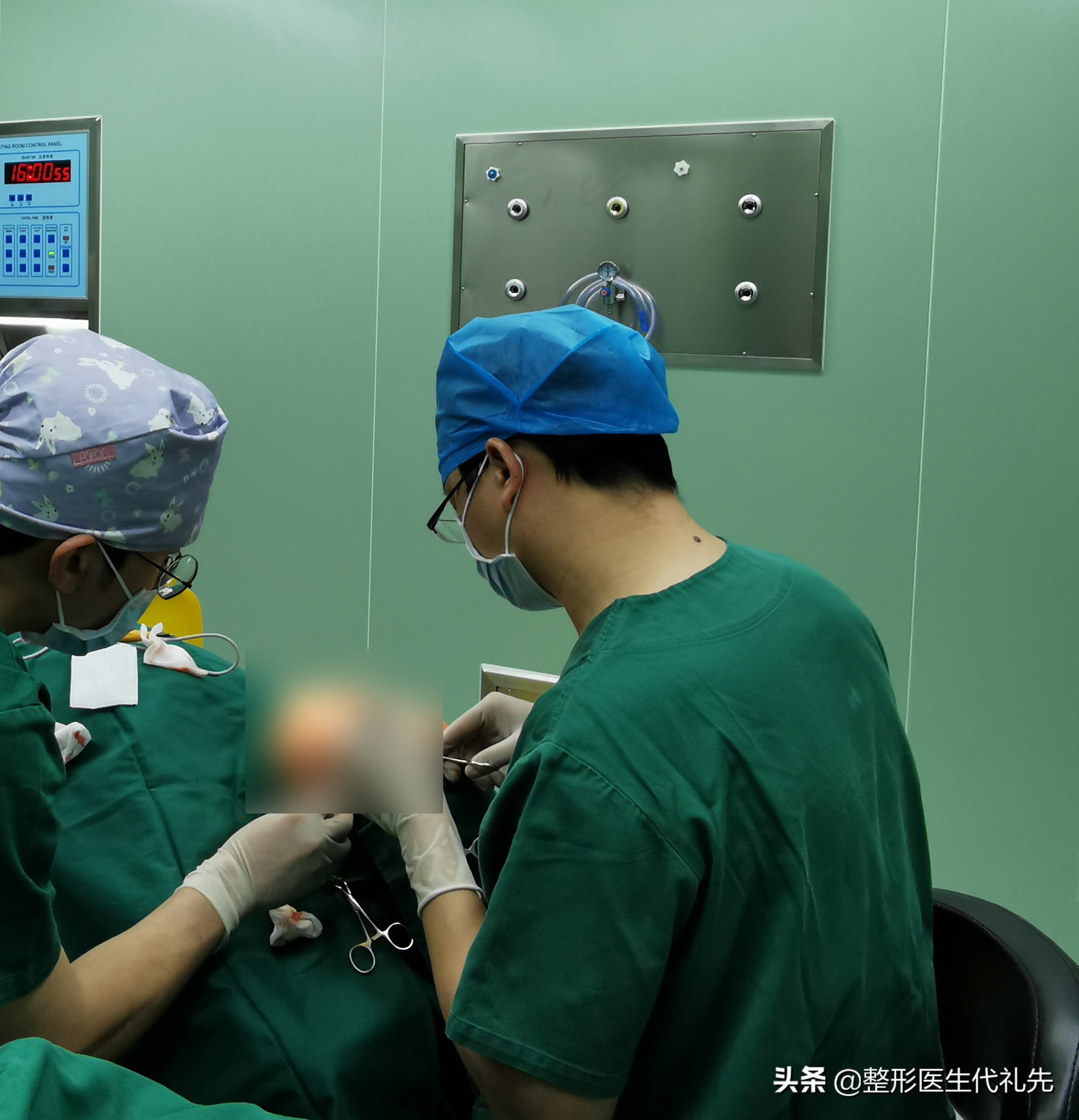 聊一聊35岁外切祛眼袋案例,为什么选择了外切而没有内切祛眼袋