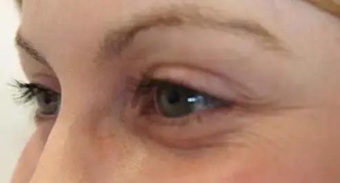 小红书护肤推荐套装,小红书护肤大神