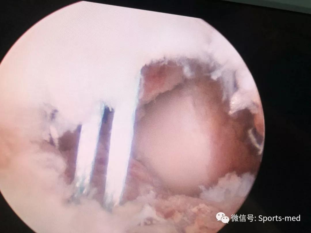 涓嶅ソ鎯圭殑浜虹殑涓夊ぇ鐗圭偣,涓夎闊у甫鎷夐暱