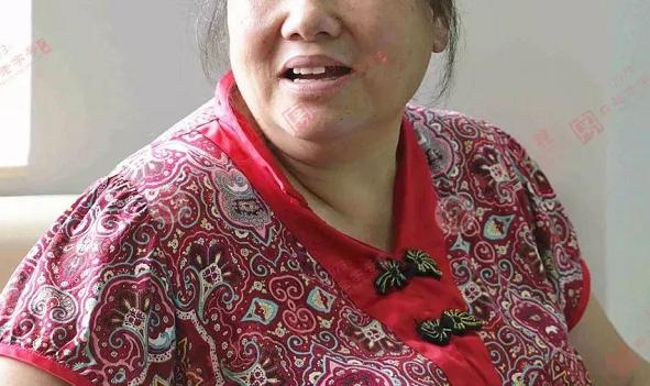 缺牙戴活动假牙40年有什么变化,上牙戴活动假牙的亲身经历