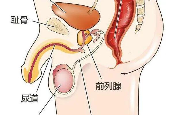 长期久坐的人怎样预防前列腺增生,如何预防前列腺炎和前列腺肥大