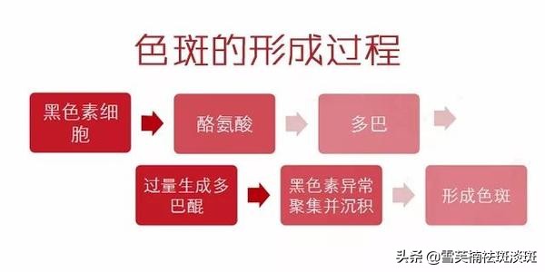 脸上斑怎么去除用什么医美,脸上的斑如何去除5个祛斑小妙招