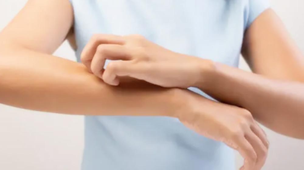 宝宝老是被蚊子咬有什么驱蚊方法,宝宝被蚊子叮了红点越来越大